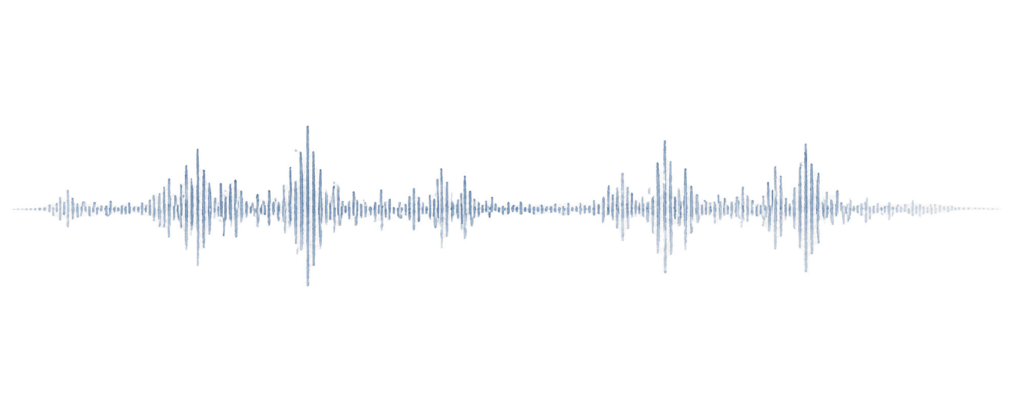 Pencil-sketch waveform — what most systems capture